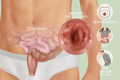 9博体育广州东大肛门肠医院花了一万多收费公道(图3)
