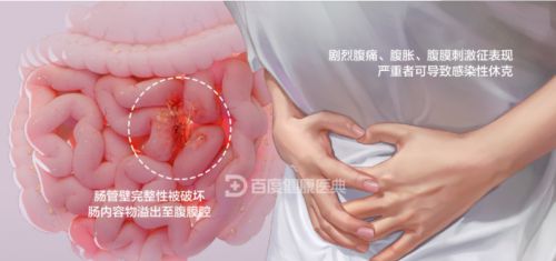 9博体育广州东大肛门肠医院花了一万多收费公道(图4)